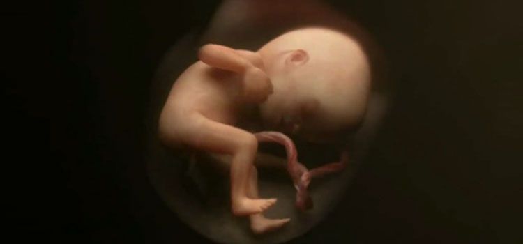 El aborto: ¿Cuestión de conciencia?